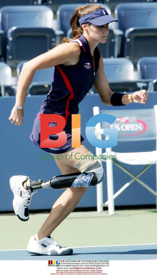 Amputee ball girl at US Open