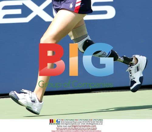 Amputee ball girl at U.S. Open