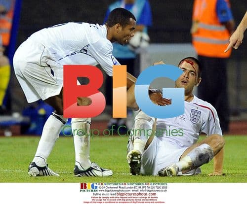 Joe Cole injured during Croatia vs England match