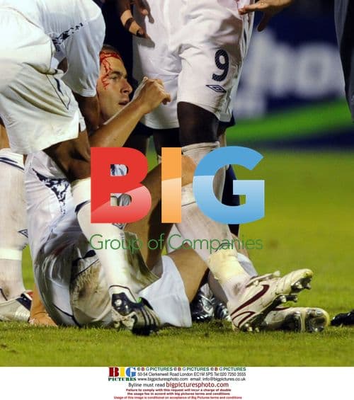 Joe Cole Head Injury, England 2008/09