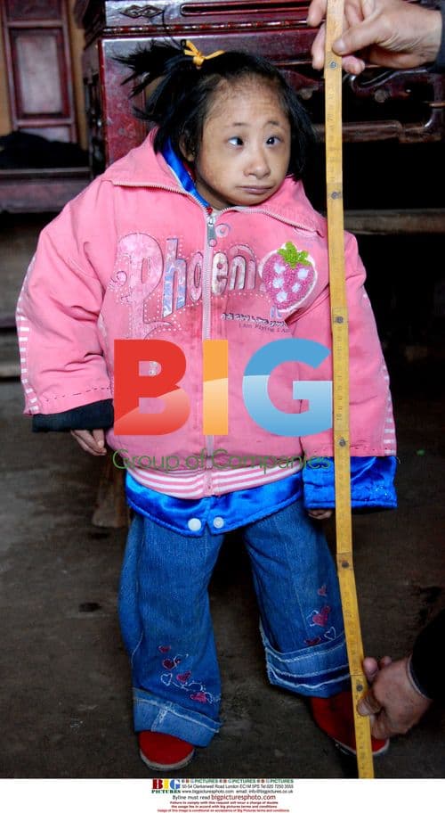 Mentally Disabled Woman in China