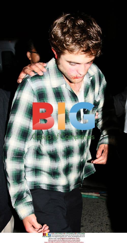 Robert Pattinson Bloody on 'Remember Me' Set