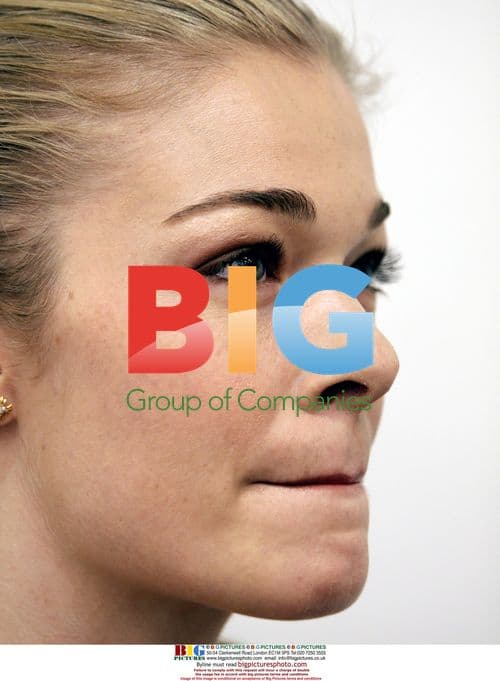 LeAnn Rimes Attends Psoriasis Act Launch