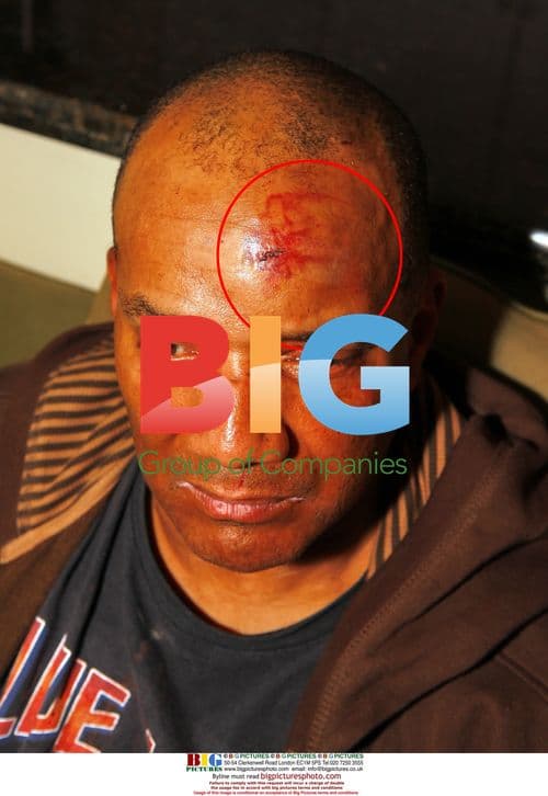 Tony Echevarria Assaulted by Mike Tyson at LAX