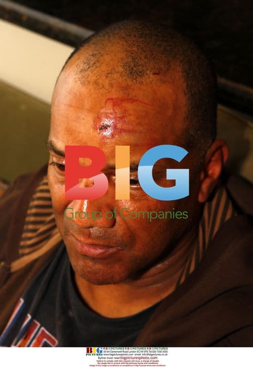 Mike Tyson Allegedly Punches Videographer