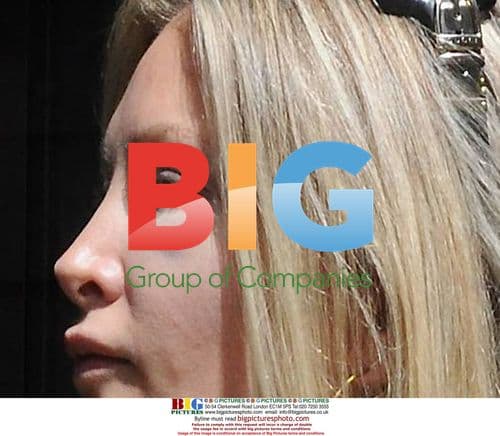 Caprice Bourret Arrives With Black Eye in Dublin